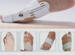 bunion aid hinged splint for bunions