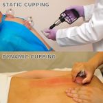 12 pcs Hijama Kit Cupping Therapy