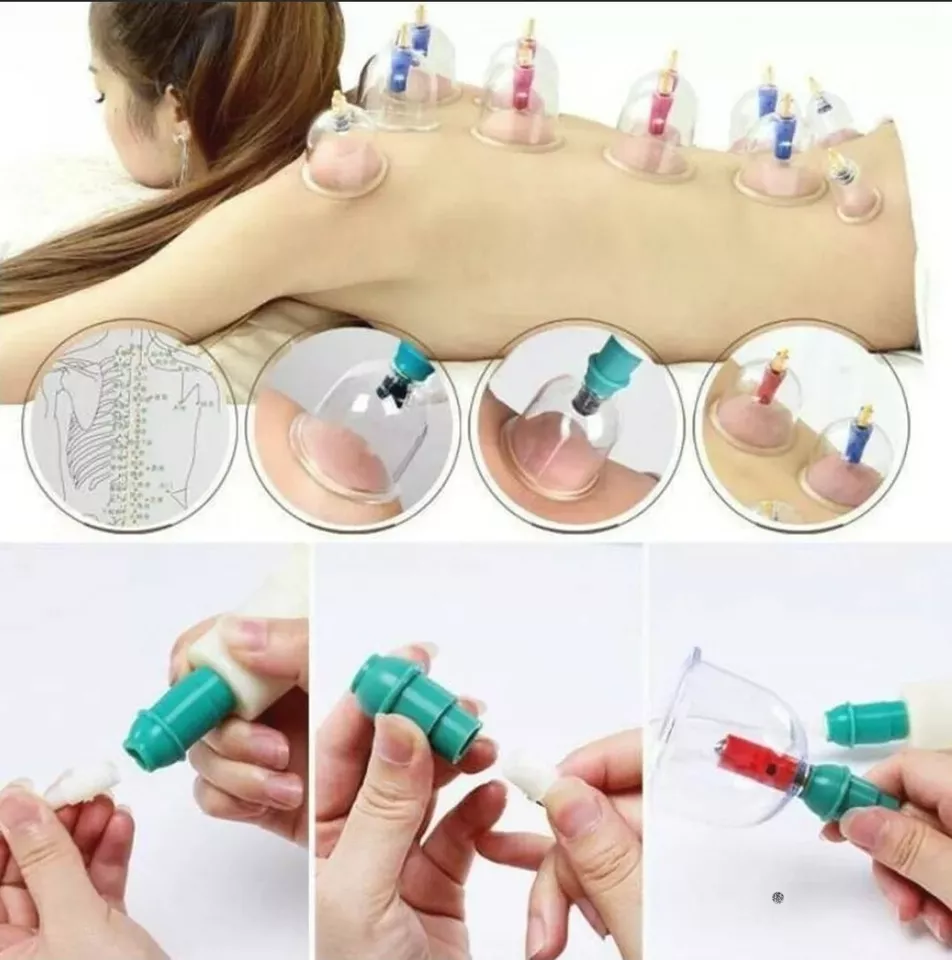 24 psc Hijama Kit Cupping Therapy