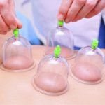 6 pcs Hijama Kit Cupping Therapy